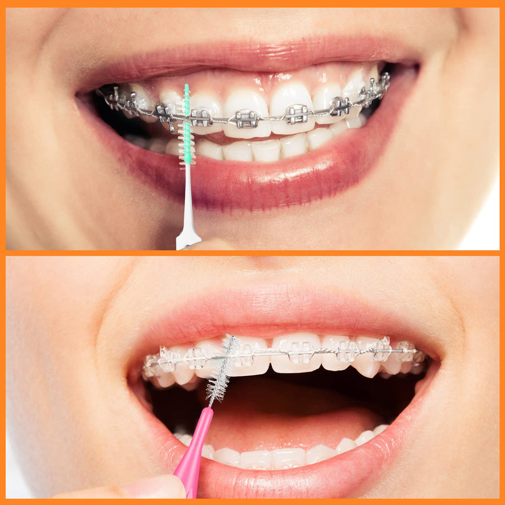 Zopeal set dentro de un bolso ideal para higiene oral en viajes