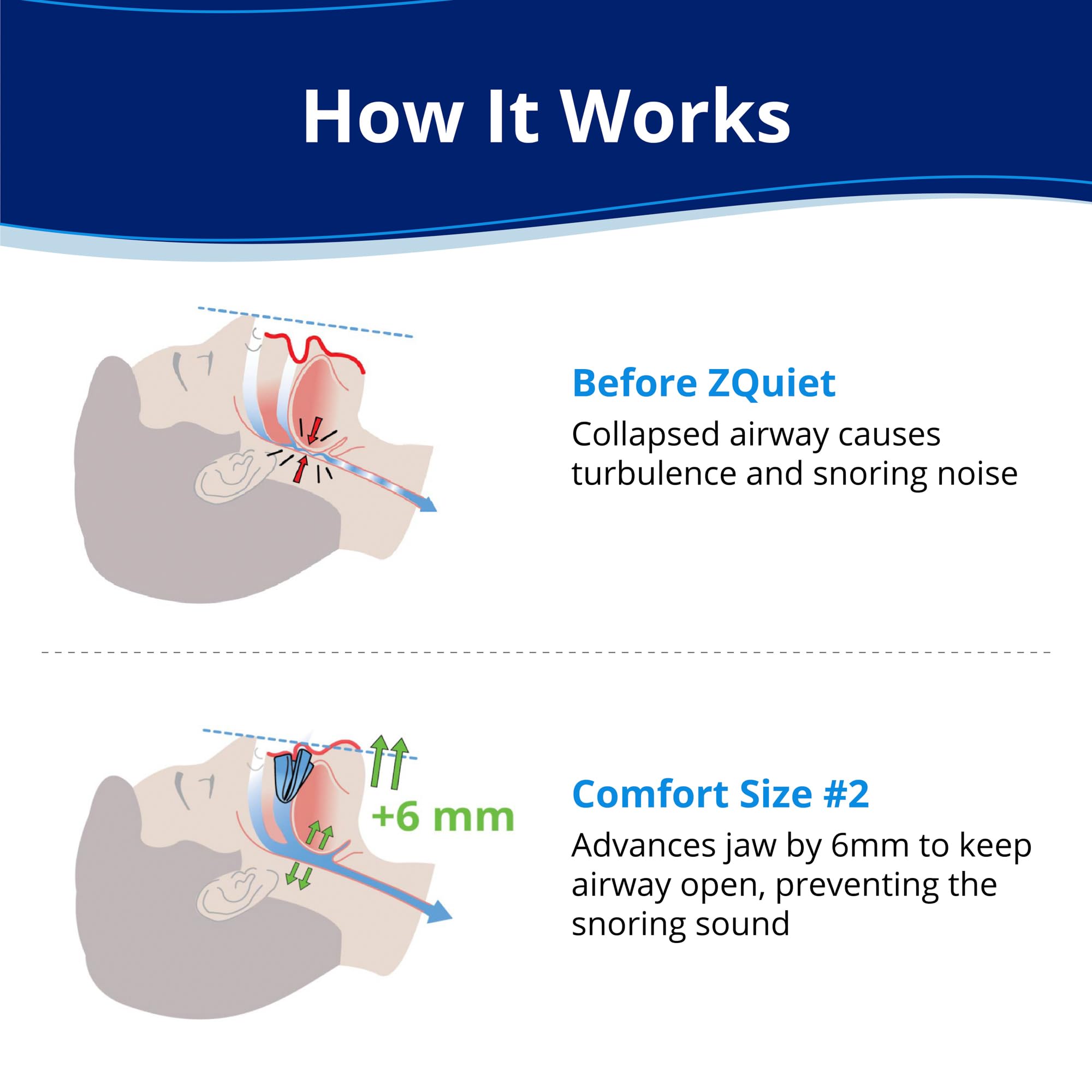 ZQuiet primer plano textura suave del material para mayor comodidad